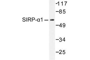 Image no. 1 for anti-Signal-Regulatory Protein alpha (SIRPA) antibody (ABIN271815) (SIRPA Antikörper)