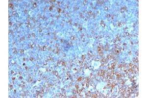 IHC testing of human tonsil stained with Cdk1 antibody.