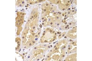 Immunohistochemistry of paraffin-embedded human kidney using PHF21B antibody at dilution of 1:100 (40x lens). (PHF21B Antikörper)