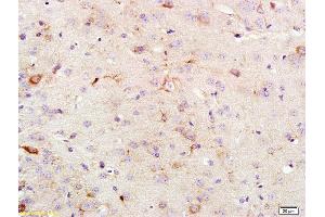 Formalin-fixed and paraffin embedded rat brain labeled with Anti KSR1 Polyclonal Antibody, Unconjugated (ABIN700645) at 1:200 followed by conjugation to the secondary antibody and DAB staining (KSR1 Antikörper  (AA 601-750))