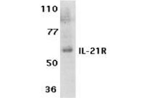 Western blot analysis of IL-21 receptor expression in human Raji cell lysate with AP30414PU-N IL-21 Receptor antibody at 1 μg /ml. (IL21 Receptor Antikörper  (Extracellular Domain))