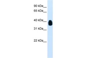 Western Blotting (WB) image for anti-Ets Variant 7 (ETV7) antibody (ABIN2461239) (ETV7 Antikörper)