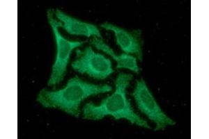 ICC/IF analysis of EPM2A in HeLa cells line, stained with DAPI (Blue) for nucleus staining and monoclonal anti-human EPM2A antibody (1:100) with goat anti-mouse IgG-Alexa fluor 488 conjugate (Green).