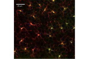 Immunofluorescence (IF) image for anti-Integrin, alpha X (Complement Component 3 Receptor 4 Subunit) (ITGAX) antibody (Alexa Fluor 647) (ABIN2657619)