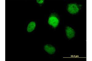 Immunofluorescence of purified MaxPab antibody to POLB on HeLa cell. (POLB Antikörper  (AA 1-335))