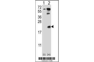 Western blot analysis of UBE2B using rabbit polyclonal UBE2B Antibody (E132) using 293 cell lysates (2 ug/lane) either nontransfected (Lane 1) or transiently transfected (Lane 2) with the UBE2B gene.