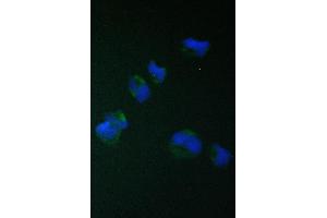 IF analysis of TIMM17A using anti-TIMM17A antibody (ABIN6719637). (TIMM17A Antikörper)