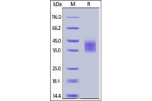 Biotinylated Human IL-2 R alpha, His,Avitag on  under reducing (R) condition.