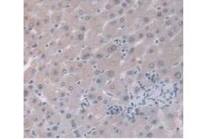 IHC-P analysis of Human Liver Tissue, with DAB staining. (ORM1 Antikörper  (AA 19-201))