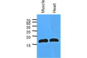 Image no. 2 for anti-Myoglobin (MB) (AA 1-154), (N-Term) antibody (ABIN953585) (Myoglobin Antikörper  (N-Term))