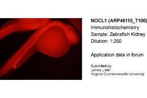 Sample Type: Zebrafish KidneyDilution: 1:250 (NOLC1 Antikörper  (C-Term))