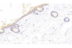 Detection of KL in Rat Skin Tissue using Polyclonal Antibody to Klotho (KL) (Klotho Antikörper  (AA 517-956))