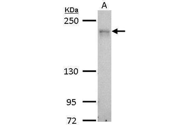 CDC42BPA Antikörper