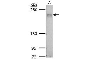 WB Image MRCK alpha antibody detects CDC42BPA protein by Western blot analysis. (CDC42BPA Antikörper)