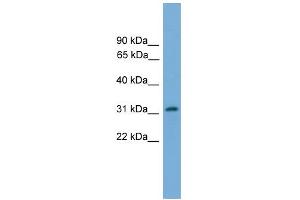 WB Suggested Anti-PIGL Antibody Titration:  0. (PIGL Antikörper  (N-Term))