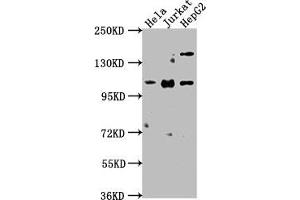 Western Blot Positive WB detected in: Hela whole cell lysate, Jurkat whole cell lysate, HepG2 whole cell lysate All lanes: KSR1 antibody at 1:2000 Secondary Goat polyclonal to rabbit IgG at 1/50000 dilution Predicted band size: 103, 98, 88, 85 kDa Observed band size: 103 kDa (KSR1 Antikörper  (AA 404-598))