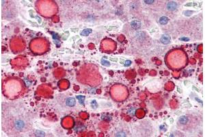 Human Liver, Lipid Droplets: Formalin-Fixed, Paraffin-Embedded (FFPE) (ADRP Antikörper  (AA 28-281))