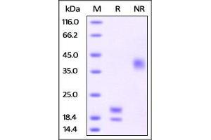 Human VEGF121, His Tag on SDS-PAGE under reducing (R) and no-reducing (NR) conditions. (VEGF Protein (AA 27-147) (His tag))