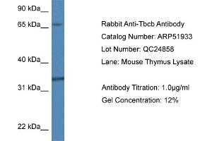 Western Blotting (WB) image for anti-Tubulin Folding Cofactor B (TBCB) (N-Term) antibody (ABIN2784694) (TBCB Antikörper  (N-Term))