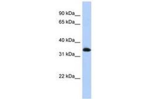 Image no. 1 for anti-Zinc Finger Protein 511 (ZNF511) (N-Term) antibody (ABIN6740520) (ZNF511 Antikörper  (N-Term))