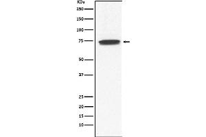 Western blot analysis of GCYA3 expression in Human fetal kidney lysate.