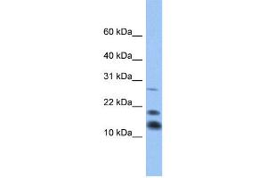 WB Suggested Anti-C1D Antibody Titration:  0. (C1D Antikörper  (Middle Region))