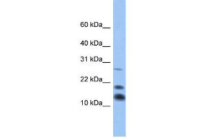 WB Suggested Anti-C1D Antibody Titration:  0.