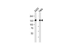 Western blot analysis of lysates from A431, Hela cell line (from left to right), using GTF2I Antibody at 1:1000 at each lane. (GTF2I Antikörper  (C-Term))