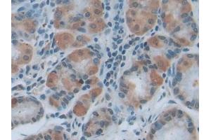 Immunohistochemistry (IHC) image for anti-Myeloid Differentiation Primary Response Gene (88) (MYD88) (AA 32-265) antibody (ABIN7433990)
