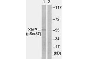 Western blot analysis of extracts from HepG2 cells treated with Anisomycin 25ug/ml 30', using XIAP (Phospho-Ser87) Antibody. (Intestinal Alkaline Phosphatase Antikörper  (pSer87))