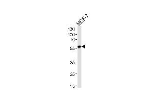 Western blot analysis of lysate from MCF-7 cell line, using ACVRL1 Antibody (N-term) (ABIN1944774 and ABIN2838516). (ACVRL1 Antikörper  (N-Term))