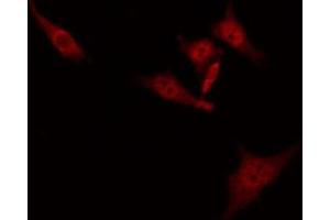 ABIN6274860 staining Hela by IF/ICC. (Aquaporin 12A Antikörper  (C-Term))