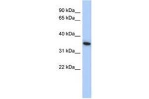 Image no. 1 for anti-MAX Interactor 1 (MXI1) (AA 215-264) antibody (ABIN6742204) (MXI1 Antikörper  (AA 215-264))