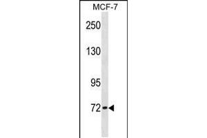Western blot analysis in MCF-7 cell line lysates (35ug/lane). (CPT2 Antikörper  (AA 212-241))