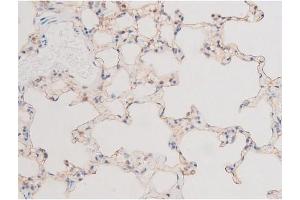 Immunohistochemistry (IHC) image for anti-LIM Domain Kinase 2 (LIMK2) (pSer283) antibody (ABIN6256239)