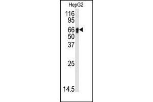 Image no. 1 for anti-Angiotensinogen (serpin Peptidase Inhibitor, Clade A, Member 8) (AGT) (N-Term) antibody (ABIN360211) (AGT Antikörper  (N-Term))