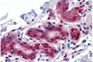 Human Breast: Formalin-Fixed, Paraffin-Embedded (FFPE) (YAP1 Antikörper  (AA 53-162))