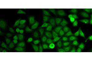 Immunofluorescence analysis of HeLa cells using IMPDH2 Polyclonal Antibody (IMPDH2 Antikörper)