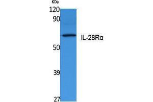Western Blotting (WB) image for anti-Interleukin 28 Receptor, alpha (Interferon, lambda Receptor) (IL28RA) (Internal Region) antibody (ABIN3180976)