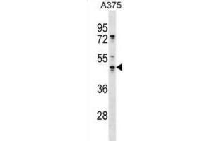 Western Blotting (WB) image for anti-Obg-Like ATPase 1 (OLA1) antibody (ABIN2998785) (OLA1 Antikörper)