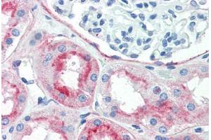 Immunohistochemistry (Paraffin-embedded Sections) (IHC (p)) image for anti-CD90 (THY1) antibody (ABIN396935)