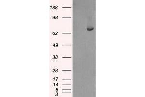 Western Blotting (WB) image for anti-Fermitin Family Member 2 (FERMT2) antibody (ABIN1499049) (FERMT2 Antikörper)