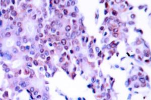 Image no. 1 for anti-Nuclear Factor-kB p65 (NFkBP65) antibody (ABIN271748) (NF-kB p65 Antikörper)