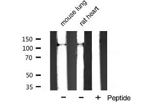 Western blot analysis of extracts of various celllines,using Integrin α3 (CD49c) Antibody.