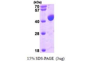 ALIX Protein (AA 1-392) (His tag)