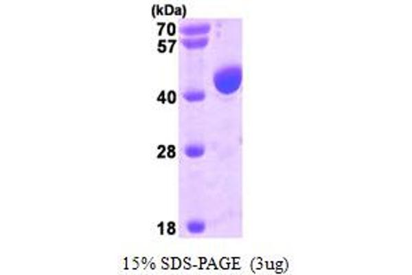 ALIX Protein (AA 1-392) (His tag)