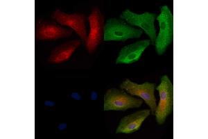 ABIN6263951 and ABIN6272734 staining  cells by IF/ICC.