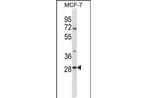 Western blot analysis in MCF-7 cell line lysates (35ug/lane). (SRPRB Antikörper  (C-Term))