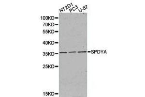 Western Blotting (WB) image for anti-Speedy Homolog A (SPDYA) antibody (ABIN1874919) (SPDYA Antikörper)