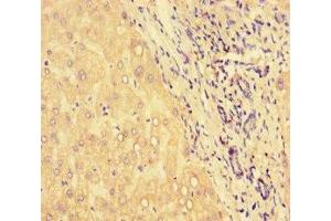 Immunohistochemistry of paraffin-embedded human liver tissue using ABIN7154859 at dilution of 1:100 (HSPA13 Antikörper  (AA 23-471))